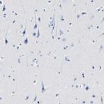 CER1 Antibody in Immunohistochemistry (Paraffin) (IHC (P))