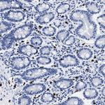 CER1 Antibody in Immunohistochemistry (Paraffin) (IHC (P))