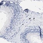 CER1 Antibody in Immunohistochemistry (Paraffin) (IHC (P))