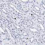 CER1 Antibody in Immunohistochemistry (Paraffin) (IHC (P))
