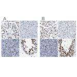 DBC1 Polyclonal Antibody