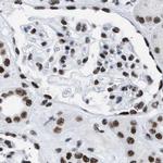 DBC1 Antibody in Immunohistochemistry (IHC)