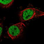 PTRHD1 Polyclonal Antibody