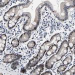 PTRHD1 Antibody in Immunohistochemistry (Paraffin) (IHC (P))