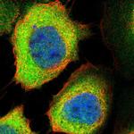 PPM1L Polyclonal Antibody