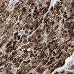 PPM1L Antibody in Immunohistochemistry (IHC)