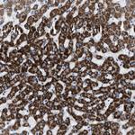 PHF17 Polyclonal Antibody