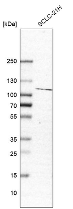 PHF17 Antibody in Western Blot (WB)