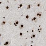 LUC7L3 Antibody in Immunohistochemistry (IHC)