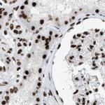 LUC7L3 Antibody in Immunohistochemistry (IHC)