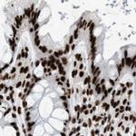 LUC7L3 Antibody in Immunohistochemistry (IHC)