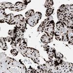 RAD21 Antibody in Immunohistochemistry (Paraffin) (IHC (P))