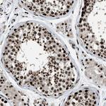 RAD21 Antibody in Immunohistochemistry (Paraffin) (IHC (P))