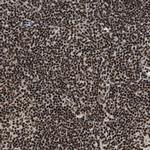 RAD21 Antibody in Immunohistochemistry (Paraffin) (IHC (P))