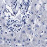 AKAP4 Antibody in Immunohistochemistry (IHC)