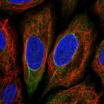 TRIM29 Polyclonal Antibody