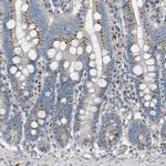 C7orf49 Antibody in Immunohistochemistry (Paraffin) (IHC (P))