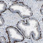 C7orf49 Antibody in Immunohistochemistry (Paraffin) (IHC (P))