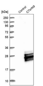 C7orf49 Antibody in Western Blot (WB)