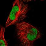 ABTB2 Polyclonal Antibody