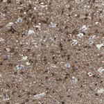 ABTB2 Antibody in Immunohistochemistry (Paraffin) (IHC (P))