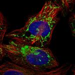 PPM1K Polyclonal Antibody