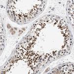 CCDC146 Antibody in Immunohistochemistry (Paraffin) (IHC (P))