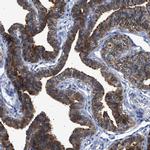 CCDC146 Antibody in Immunohistochemistry (IHC)