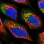 PNPLA8 Polyclonal Antibody