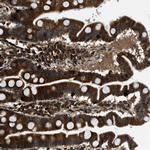 PNPLA8 Antibody in Immunohistochemistry (Paraffin) (IHC (P))