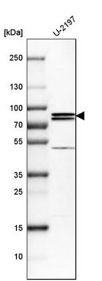 PNPLA8 Antibody in Western Blot (WB)