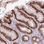 ZNF425 Antibody in Immunohistochemistry (Paraffin) (IHC (P))