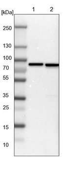 ABCF2 Antibody in Western Blot (WB)