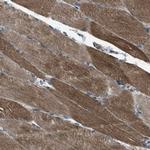 SVIL Polyclonal Antibody