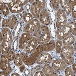 PPA1 Antibody in Immunohistochemistry (Paraffin) (IHC (P))