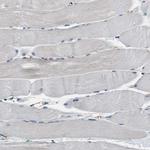 PPA1 Antibody in Immunohistochemistry (Paraffin) (IHC (P))