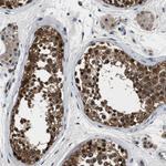 PPA1 Antibody in Immunohistochemistry (Paraffin) (IHC (P))