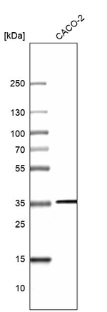 PPA1 Antibody in Western Blot (WB)
