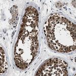 PPA1 Antibody in Immunohistochemistry (IHC)
