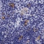 TSCOT Polyclonal Antibody