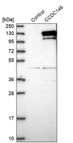 CCDC146 Antibody in Western Blot (WB)