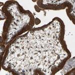 PTCD1 Antibody in Immunohistochemistry (IHC)