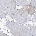 AHNAK2 Antibody in Immunohistochemistry (IHC)