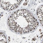 LSM8 Antibody in Immunohistochemistry (Paraffin) (IHC (P))