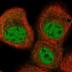 KLHDC10 Polyclonal Antibody