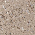 KLHDC10 Antibody in Immunohistochemistry (Paraffin) (IHC (P))