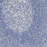 KLHDC10 Antibody in Immunohistochemistry (Paraffin) (IHC (P))