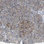 KLHDC10 Antibody in Immunohistochemistry (Paraffin) (IHC (P))