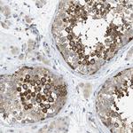 KLHDC10 Antibody in Immunohistochemistry (Paraffin) (IHC (P))