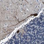 Ubinuclein 2 Polyclonal Antibody